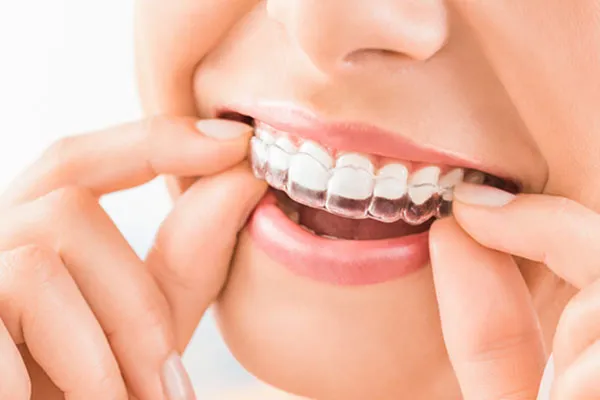 orthodontics invisalign treatment