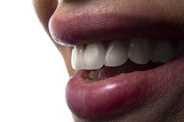 close-up shot of a person's smile showing their teeth