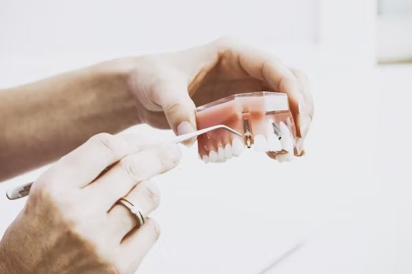 image of hands showing a dental implant on a dental model