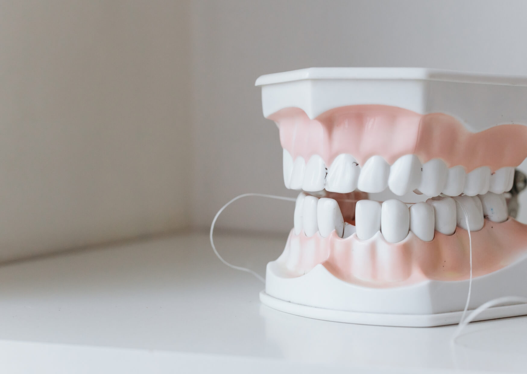 Dental model showing a cracked tooth between healthy teeth, illustrating what a cracked tooth looks like and how a fracture can affect the tooth structure.