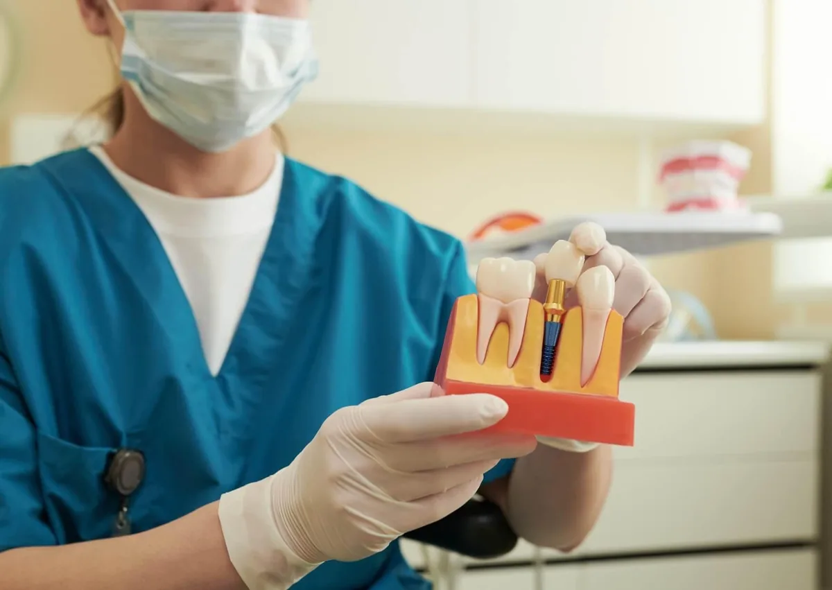 Dental professional holding an implant model to explain affordable dental implant options.