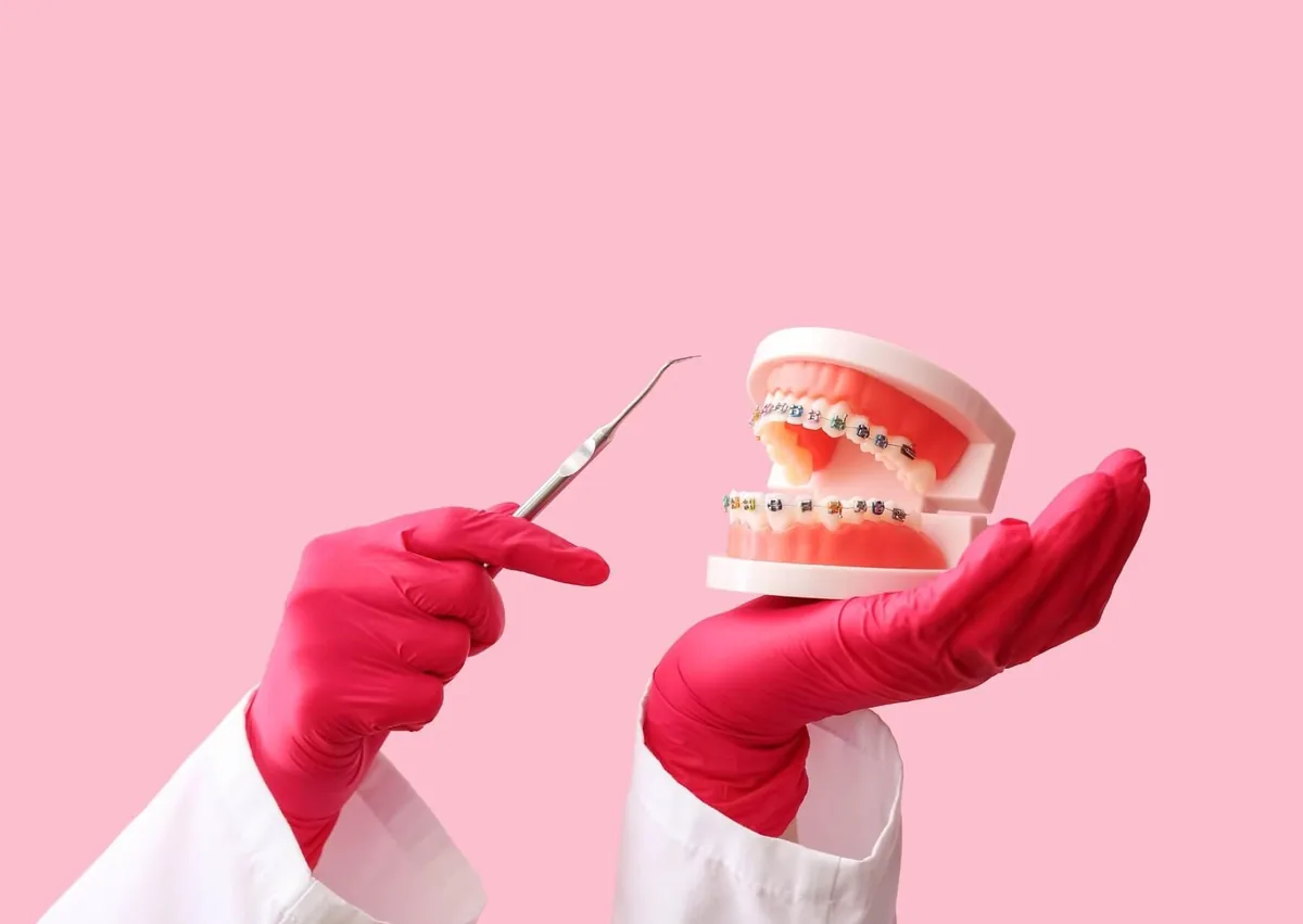 Dental model with metal braces representing braces cost with insurance.